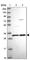 Transmembrane P24 Trafficking Protein 5 antibody, HPA050289, Atlas Antibodies, Western Blot image 