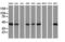 ADP Ribosylation Factor GTPase Activating Protein 1 antibody, LS-C172811, Lifespan Biosciences, Western Blot image 