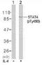 Signal Transducer And Activator Of Transcription 4 antibody, TA309957, Origene, Western Blot image 