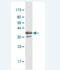 Progesterone Receptor Membrane Component 1 antibody, H00010857-M03-100ug, Novus Biologicals, Western Blot image 