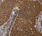 Decapping MRNA 1A antibody, MBS2522953, MyBioSource, Immunohistochemistry paraffin image 