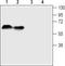 Solute Carrier Family 6 Member 4 antibody, TA328879, Origene, Western Blot image 