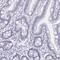 DExD-Box Helicase 39B antibody, PA5-66172, Invitrogen Antibodies, Immunohistochemistry frozen image 