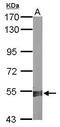 Aldehyde Dehydrogenase 1 Family Member A2 antibody, TA307922, Origene, Western Blot image 