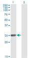 Ring Finger Protein 114 antibody, H00055905-M03, Novus Biologicals, Western Blot image 