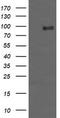 Phosphoinositide-3-Kinase Regulatory Subunit 5 antibody, TA505826S, Origene, Western Blot image 