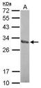 Zinc Finger Protein 414 antibody, PA5-31681, Invitrogen Antibodies, Western Blot image 
