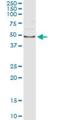 Aryl Hydrocarbon Receptor Interacting Protein Like 1 antibody, H00023746-M23, Novus Biologicals, Immunoprecipitation image 