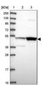 McKusick-Kaufman Syndrome antibody, NBP1-92123, Novus Biologicals, Western Blot image 