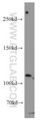 rSec8 antibody, 11913-1-AP, Proteintech Group, Western Blot image 