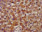 NAD(P) Dependent Steroid Dehydrogenase-Like antibody, CSB-PA618994LA01HU, Cusabio, Immunohistochemistry paraffin image 