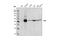 FYN Proto-Oncogene, Src Family Tyrosine Kinase antibody, 4023T, Cell Signaling Technology, Western Blot image 