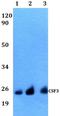 Colony Stimulating Factor 3 antibody, GTX66773, GeneTex, Western Blot image 