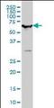 SWI/SNF Related, Matrix Associated, Actin Dependent Regulator Of Chromatin, Subfamily D, Member 2 antibody, orb94765, Biorbyt, Western Blot image 