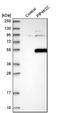 Phosphatidylinositol-5-Phosphate 4-Kinase Type 2 Gamma antibody, NBP1-92272, Novus Biologicals, Western Blot image 