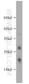 Tubulin Polymerization Promoting Protein Family Member 2 antibody, 13633-1-AP, Proteintech Group, Western Blot image 