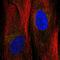 Angiopoietin Like 2 antibody, PA5-59505, Invitrogen Antibodies, Immunofluorescence image 