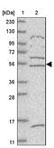 Zinc Finger Protein 232 antibody, PA5-55578, Invitrogen Antibodies, Western Blot image 