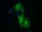 Mitogen-Activated Protein Kinase Kinase 1 antibody, GTX84167, GeneTex, Immunocytochemistry image 