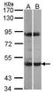 MAPK Activated Protein Kinase 5 antibody, PA5-21880, Invitrogen Antibodies, Western Blot image 