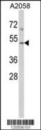 Actin Related Protein 3 antibody, MBS9211369, MyBioSource, Western Blot image 