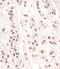 Cell Division Cycle 73 antibody, 63-825, ProSci, Immunohistochemistry paraffin image 