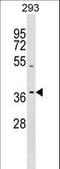 Taste 2 Receptor Member 13 antibody, LS-C157137, Lifespan Biosciences, Western Blot image 