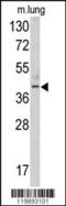 Thymine DNA Glycosylase antibody, 62-365, ProSci, Western Blot image 