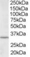 Inhibitor Of Growth Family Member 2 antibody, TA302798, Origene, Western Blot image 