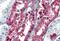 Glutathione S-Transferase Pi 1 antibody, MBS247741, MyBioSource, Immunohistochemistry paraffin image 