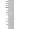 Proteasome 26S Subunit, Non-ATPase 9 antibody, abx218041, Abbexa, Western Blot image 