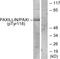 Paxillin antibody, LS-C117454, Lifespan Biosciences, Western Blot image 