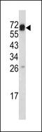 Endoglin antibody, 61-573, ProSci, Western Blot image 