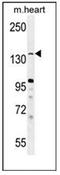 Lysine Demethylase 3B antibody, AP52267PU-N, Origene, Western Blot image 