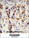 Mtr4 Exosome RNA Helicase antibody, 63-621, ProSci, Immunohistochemistry paraffin image 