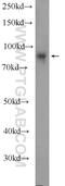 Two Pore Segment Channel 1 antibody, 23758-1-AP, Proteintech Group, Western Blot image 