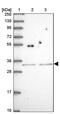SH2B Adaptor Protein 2 antibody, PA5-62326, Invitrogen Antibodies, Western Blot image 