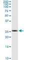 Ring Finger Protein 170 antibody, H00081790-M01, Novus Biologicals, Western Blot image 