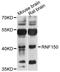Ring Finger Protein 150 antibody, STJ26326, St John