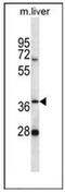 PNKD Metallo-Beta-Lactamase Domain Containing antibody, AP53364PU-N, Origene, Western Blot image 