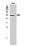 Serine/Threonine Kinase 38 Like antibody, STJ94368, St John