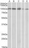 Corticosteroid 11-beta-dehydrogenase isozyme 1 antibody, 42-861, ProSci, Western Blot image 