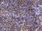 NME/NM23 Nucleoside Diphosphate Kinase 1 antibody, LS-C175621, Lifespan Biosciences, Immunohistochemistry paraffin image 