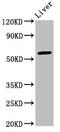 AT-Rich Interaction Domain 3A antibody, CSB-PA858728LA01HU, Cusabio, Western Blot image 