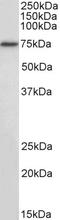 Regulatory Factor X5 antibody, STJ72260, St John