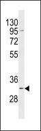 Translational Activator Of Cytochrome C Oxidase I antibody, LS-C157128, Lifespan Biosciences, Western Blot image 