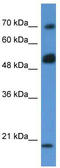 Rho GTPase Activating Protein 36 antibody, TA340369, Origene, Western Blot image 