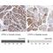 CTP Synthase 1 antibody, NBP2-57099, Novus Biologicals, Immunohistochemistry paraffin image 