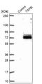 Transforming Growth Factor Beta Induced antibody, NBP2-48534, Novus Biologicals, Western Blot image 