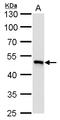 Ubiquinol-Cytochrome C Reductase Core Protein 1 antibody, GTX630413, GeneTex, Western Blot image 